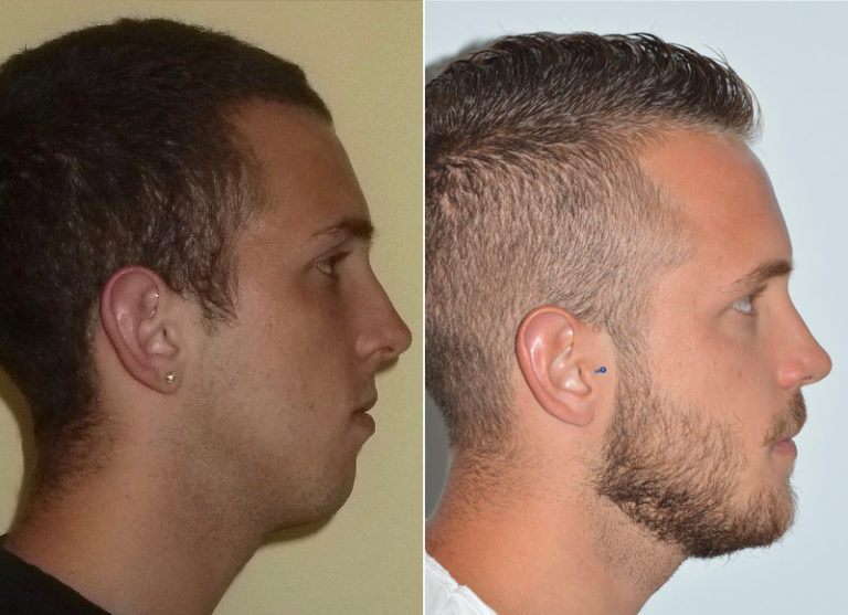 Chirurgia minimamente invasiva – Ortognatica Roma