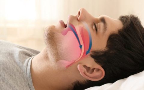 Apnee ostruttive del sonno: quando il problema è di natura dentoscheletrica