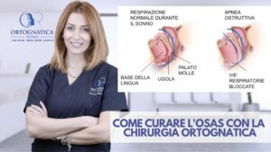 Osas_Ortognatica