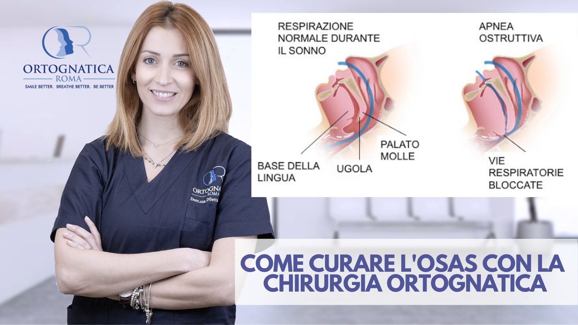 Osas_Ortognatica