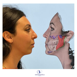 previsualizzazione 3d 