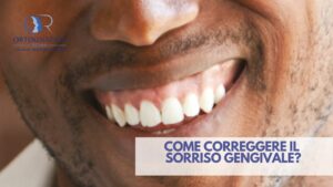 Sorriso Gengivale