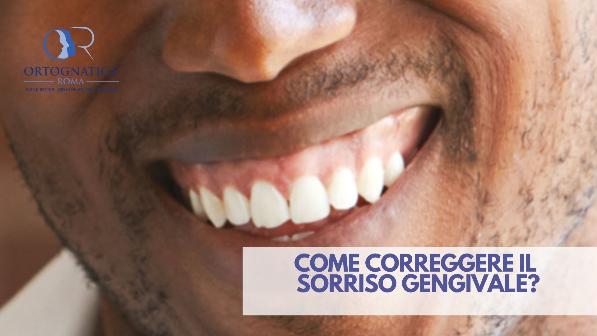 Sorriso Gengivale