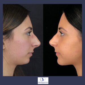 Beuaty-full chin