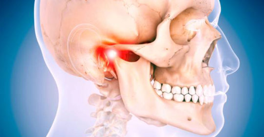 La mandibola fa Click? Può servire il bite!