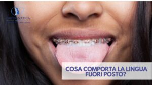 Lingua fuori posto