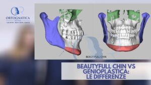 beautyfull chin