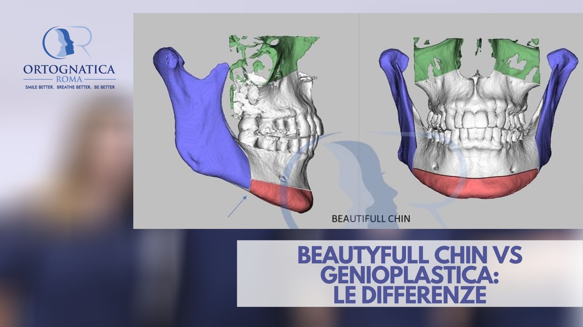 beautyfull chin