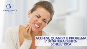 Acufeni e malocclusione