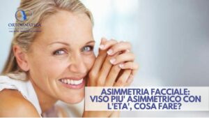 viso asimmetrico