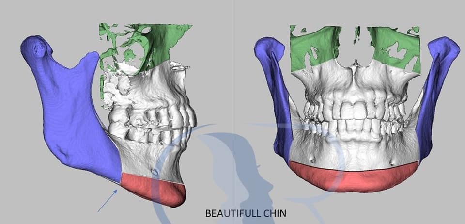 Beauty-full-chin