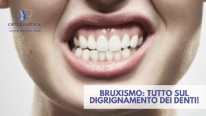 Bruxismo