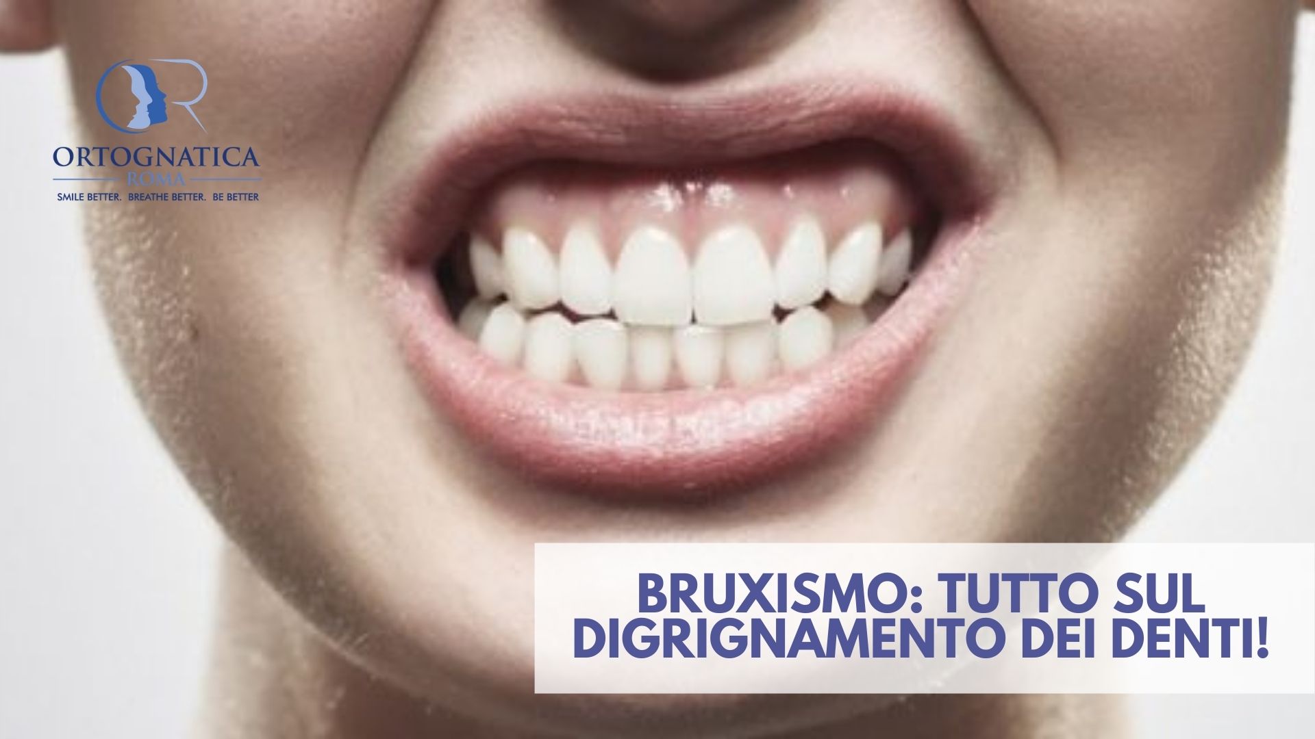 Bruxismo