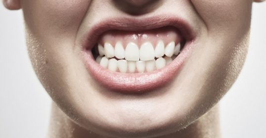 Bruxismo: tutto sul digrignamento dei denti!