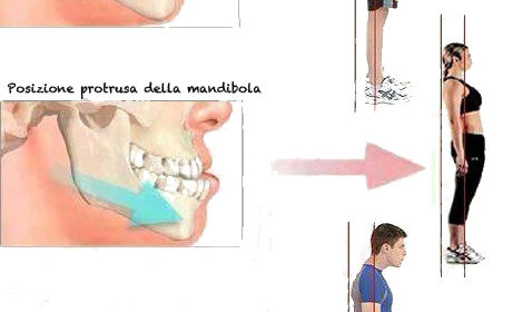 postura
