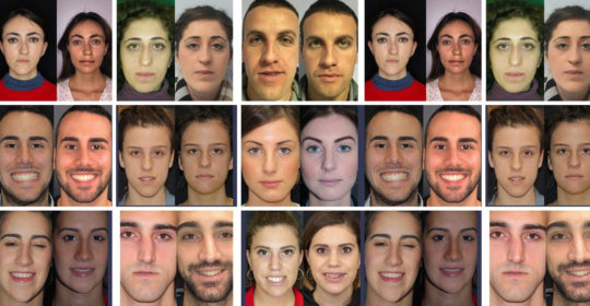 Asimmetria facciale: quando il viso risulta poco armonico