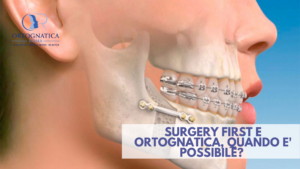 Surgery first e ortognatica
