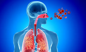 sindrome_sinuso_bronchiale