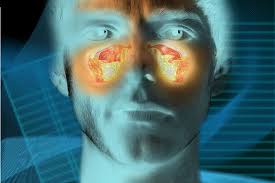 Neoplasia naso