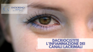 Dacriocistite