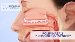 Polipi Nasali prevenzione