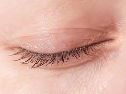 palpebra