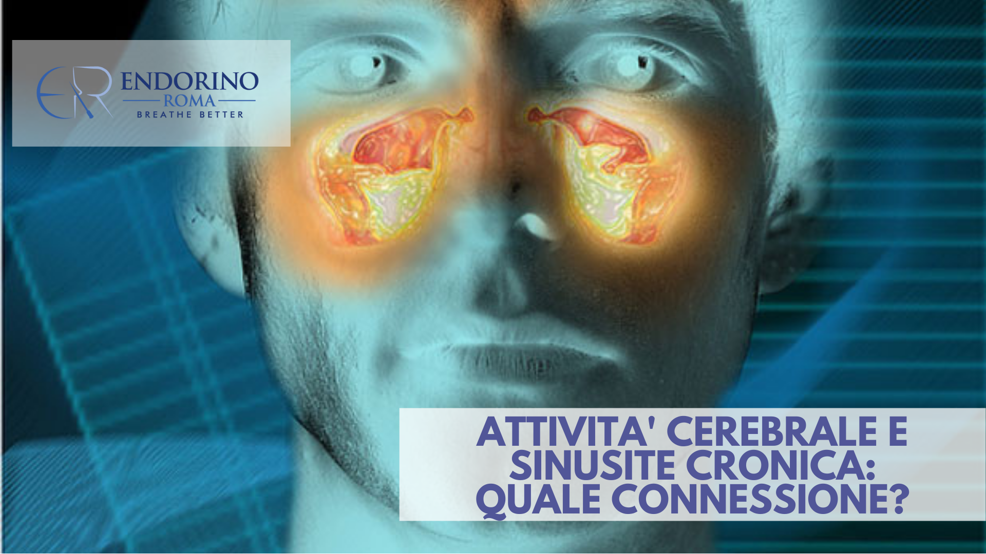 Sinusite cronica e attività cerebrale