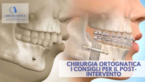 Consigli post operatorio ortognatica