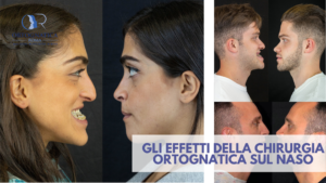 Ortognatica e Naso
