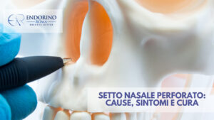Setto nasale perforato