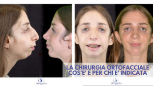 Chirurgia Ortofacciale