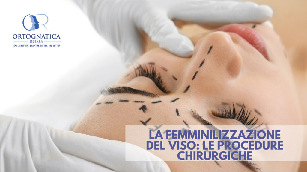 Femminilizzazione del viso