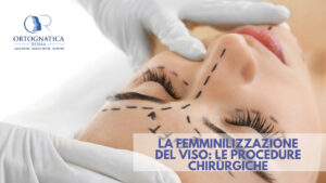 Femminilizzazione del viso