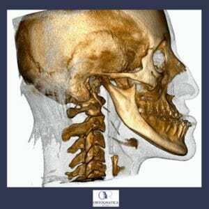 3d planning in orthognathic surgery